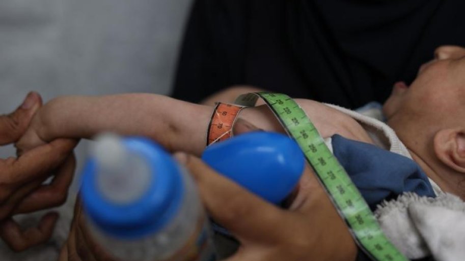 Un enfant palestinien souffrant de malnutrition passe un examen médical dans une clinique MSF à Gaza. © Nour Alsaqqa/MSF