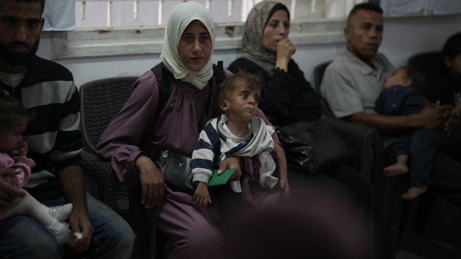 Une mère palestinienne et son enfant, souffrant tous les deux de malnutrition à Gaza-ville.