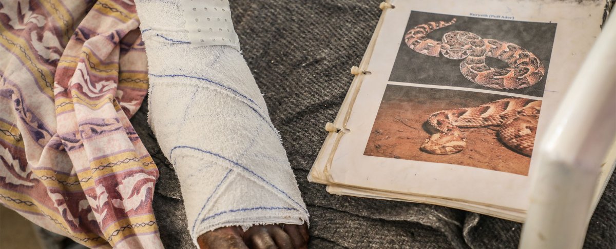 Der Fuss von Arop Magut neben den Fotos der Puffotter, die ihn gebissen hat. Arop wurde im MSF-Spital in Agok behandelt.