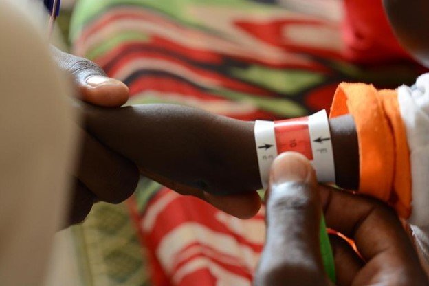 Messung des Oberarmumfangs eines Kindes in der Klinik von Ärzte ohne Grenzen im Camp Samsam in Nord-Darfur. Dies ist eine unverzichtbare Massnahme, um Mangelernährung festzustellen. © Mohammed Jamal