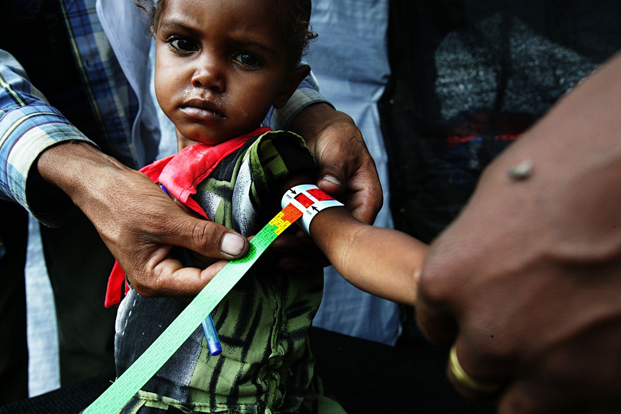 Crise nutritionnelle en Ethiopie (Sembete. Oromia). 2008.