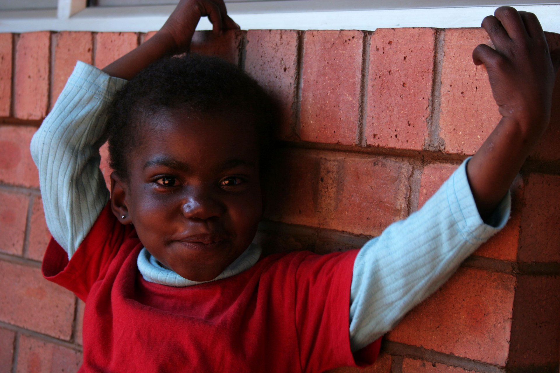 Lindo une petite fille atteinte de tuberculose multi-résistante, Swaziland, 2009