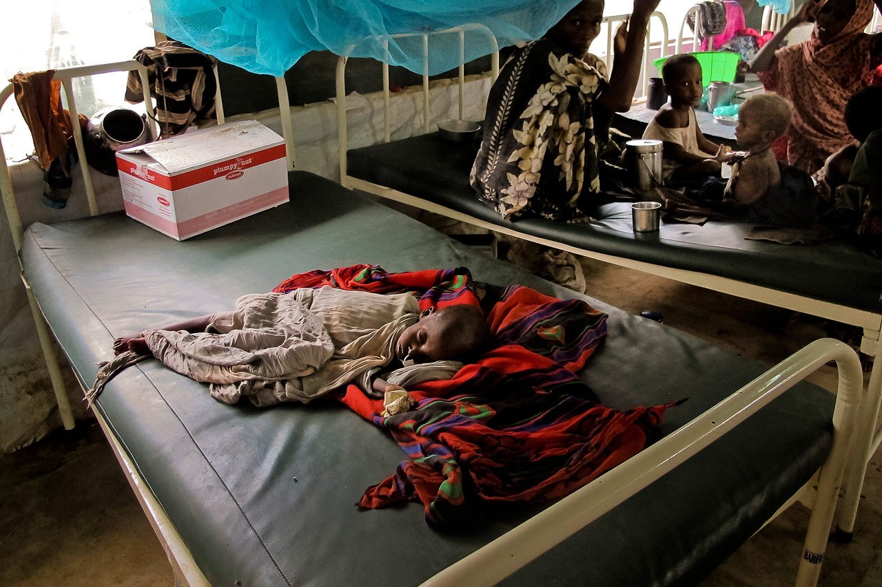 Dans les régions affectées, MSF prend en charge plus de 10 000 enfants sévèrement malnutris.
