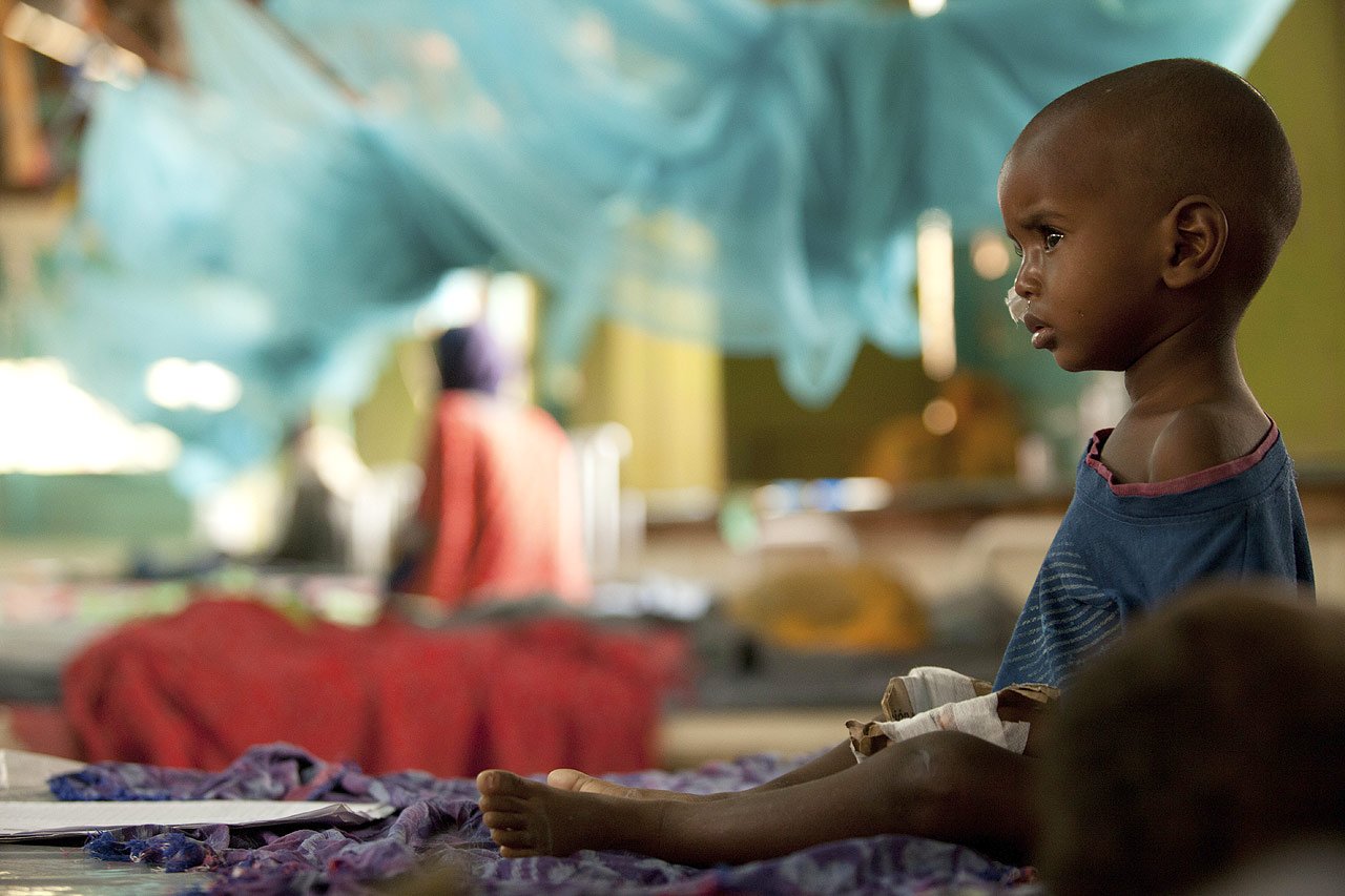 Plus de 2 100 enfants sont traités dans les programmes nutritionnels et 200 ont été admis à l’hôpital pour des complications médicales.