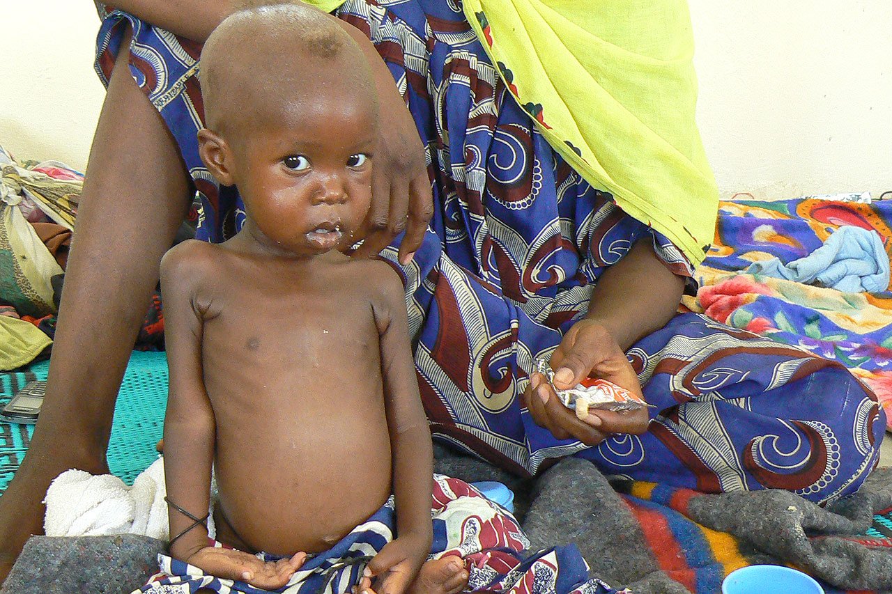 Notre première priorité est de réduire le taux de mortalité chez le quart d’enfants qui souffrent de malnutrition aiguë