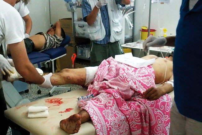 A la mi-août, MSF avait accueilli plus de 300 patients et pratiqué 150 interventions chirurgicales.
