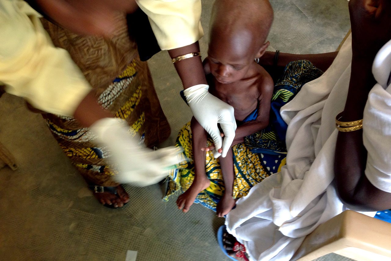 « Le paludisme et la malnutrition forment une combinaison mortelle. »
