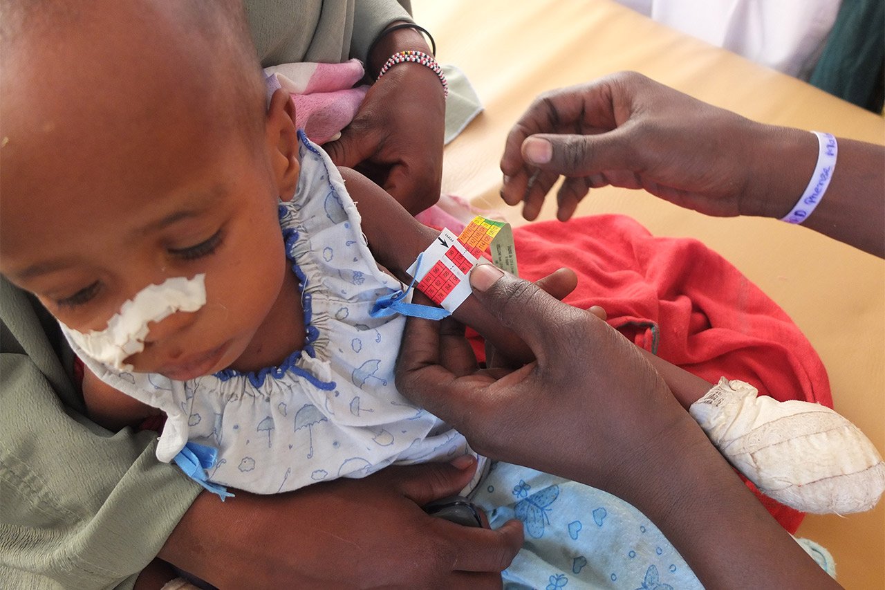 Depuis janvier 2011, MSF administrait le service des urgences pédiatriques pour les enfants de moins de 15 ans à l'hôpital de Massakory.
