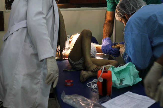 L’équipe médicale MSF, de l’hôpital de Mossoul Ouest, soigne un enfant blessé suite à une explosion dans la vieille ville.