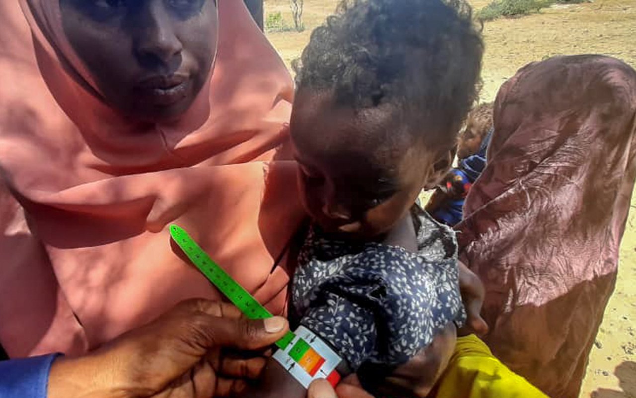 Dépistage de la malnutrition à El Wak, Jubbaland. Décembre 2020