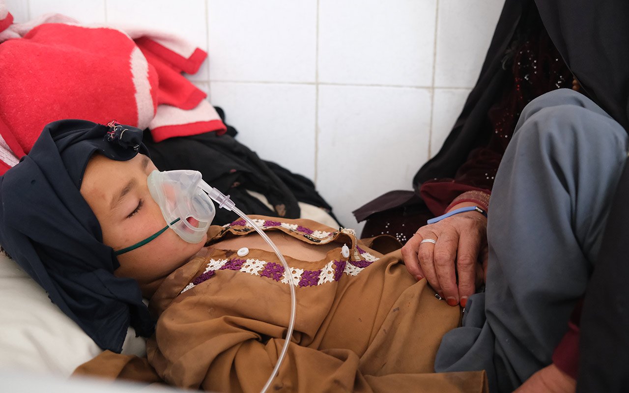 Un enfant atteint de rougeole dans une salle de l'hôpital Boost à Lashkar Gah. Afghanistan