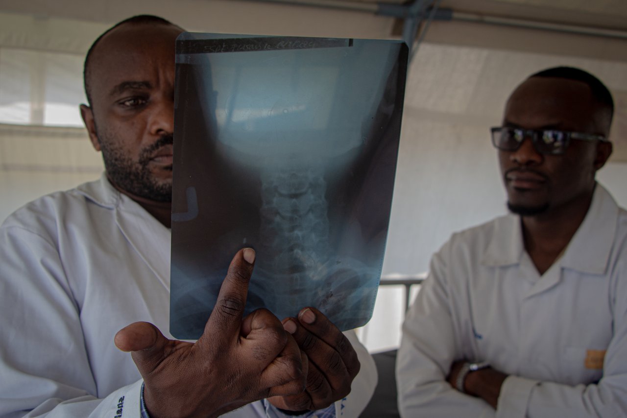 Un médecin étudie la radio d'un patient qui a été blessé par balle. Février 2024. Nord-Kivu. 