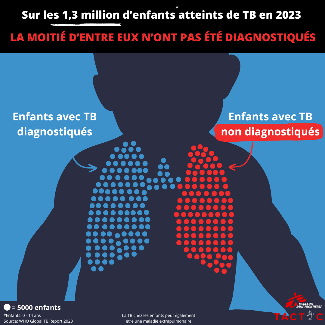 Tuberculose chez les enfants : souvent non diagnostiquée