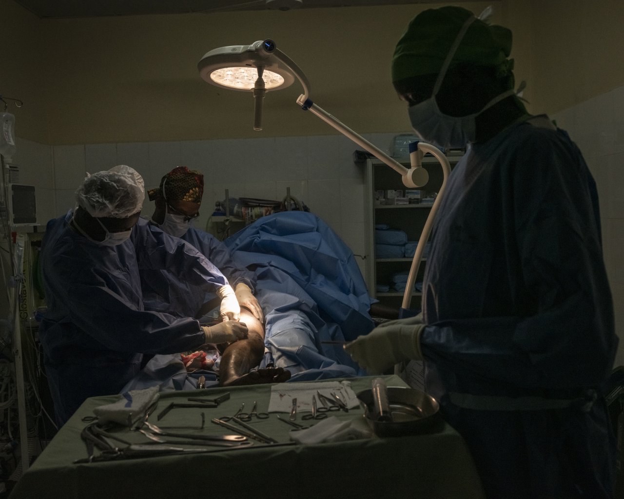 Des chirurgiens MSF opèrent un patient victime d'une blessure par balle ayant entraîné une fracture osseuse complexe, à Abyei, au Soudan du Sud.