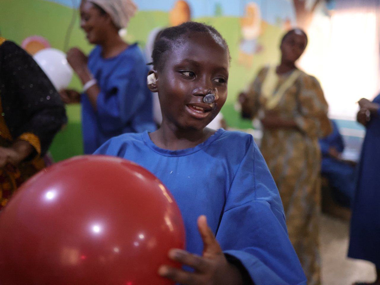 Maryam Bashir, 12 ans, jouant avec un ballon cinq jours après avoir subi une chirurgie reconstructive du nez, lors d'une fête organisée par l'équipe de santé mentale de MSF, à l'hôpital pour enfants Noma soutenu par MSF dans l'État de Sokoto, au Nigéria. 