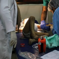 L’équipe médicale MSF, de l’hôpital de Mossoul Ouest, soigne un enfant blessé suite à une explosion dans la vieille ville.