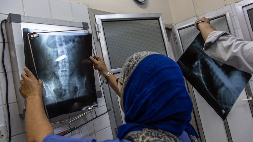 Une chirurgienne analyse une radiographie