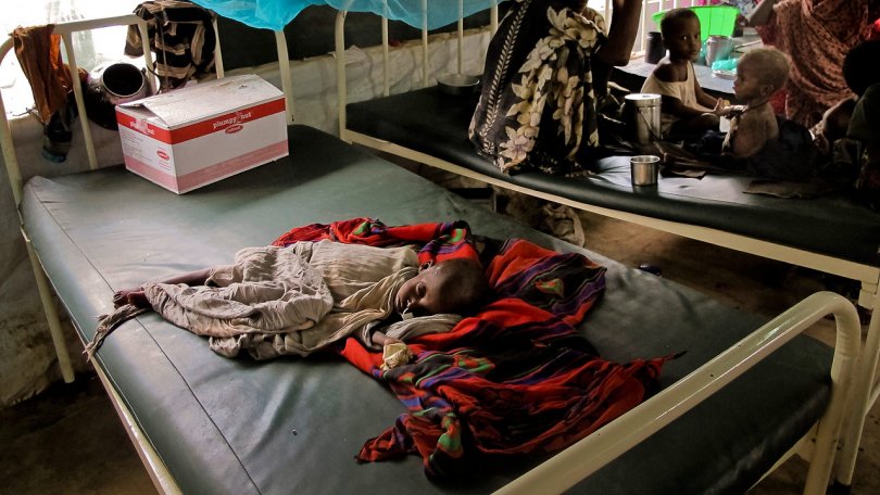 Dans les régions affectées, MSF prend en charge plus de 10 000 enfants sévèrement malnutris.