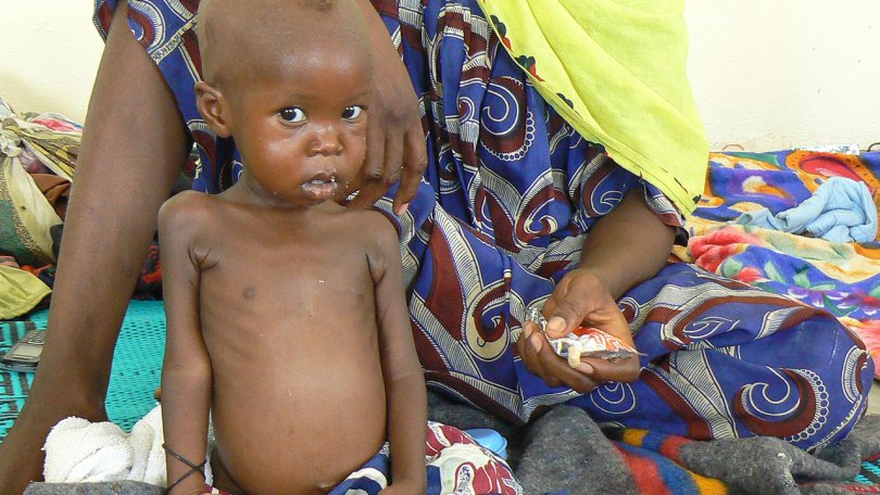 Notre première priorité est de réduire le taux de mortalité chez le quart d’enfants qui souffrent de malnutrition aiguë