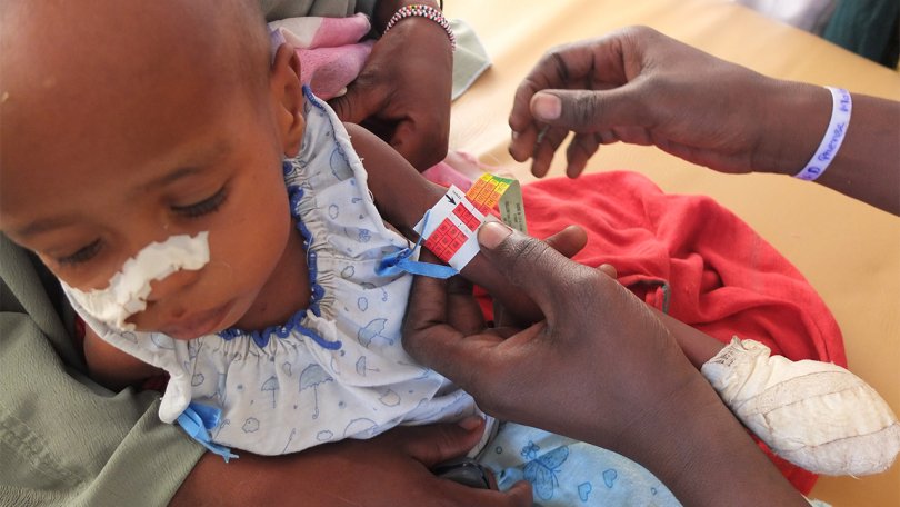Depuis janvier 2011, MSF administrait le service des urgences pédiatriques pour les enfants de moins de 15 ans à l'hôpital de Massakory.