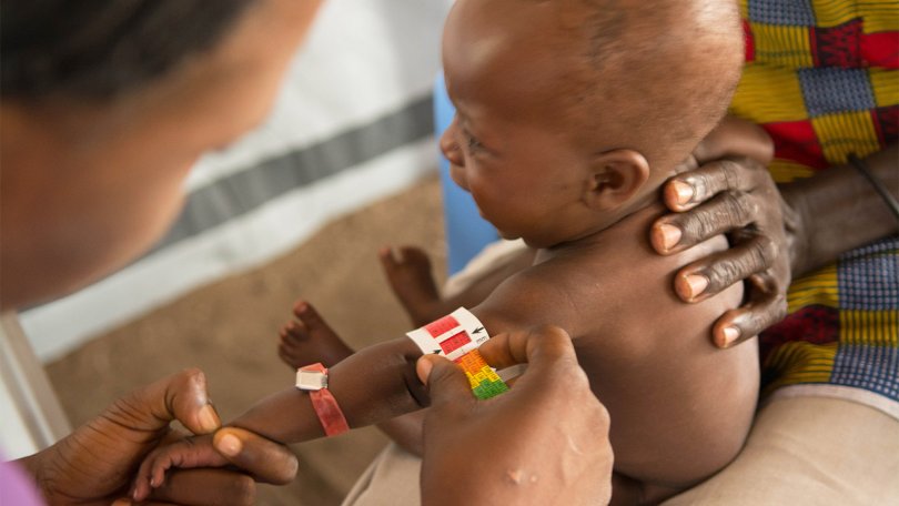 « La malnutrition ne fait pas que ralentir la croissance, elle affaiblit les défenses immunitaires contre les maladies les plus courantes. »