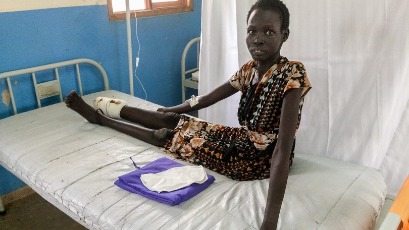Nyekuony marche aujourd’hui avec des béquilles. Si elle a eu la chance de survivre, une prise en charge plus rapide aurait cependant pu sauver sa jambe.