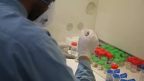 Un technicien MSF analyse des échantillons dans le laboratoire de l'hôpital de Médecins Sans Frontières (MSF) spécialisé dans la tuberculose résistante aux médicaments (DR-TB) dans la ville de Kandahar, dans la province de Kandahar, en Afghanistan. 10 mars 2022.